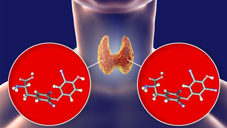 A pajzsmirigy túlműködés lelki okai